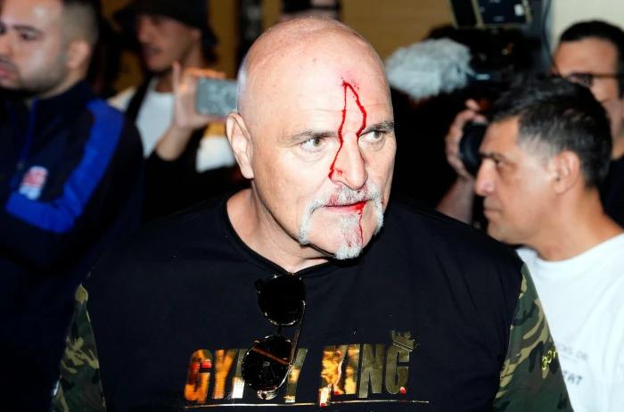 John Fury left with head wound after altercation with Oleksandr Usyk's camp