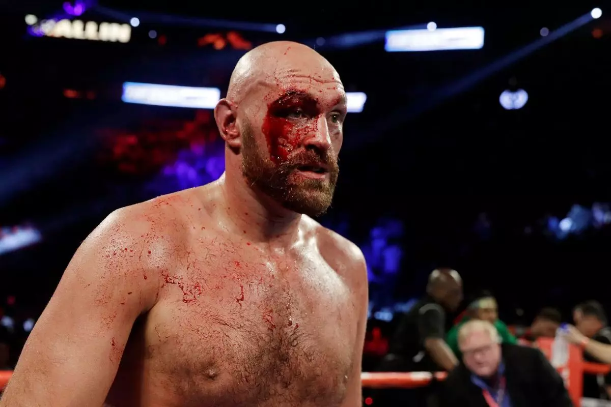 Tyson Fury