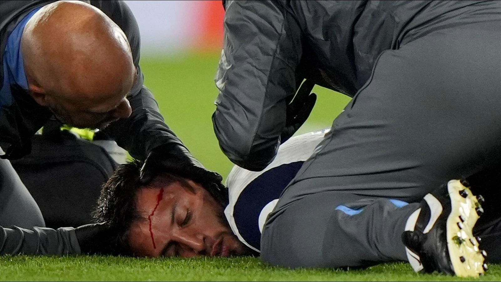 Rodrigo Bentancur of Tottenham treated for head injury