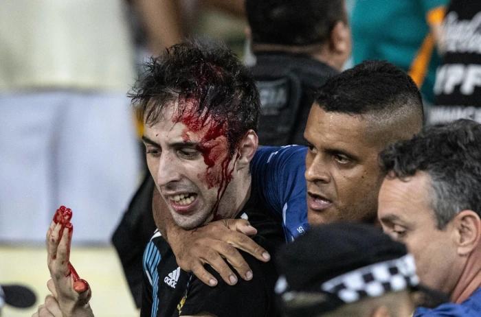 Crowd trouble at Maracana mars famous Argentina victory against Brazil